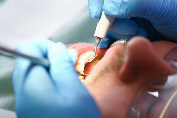 Best Broken Tooth Emergency  in Hampton, IA